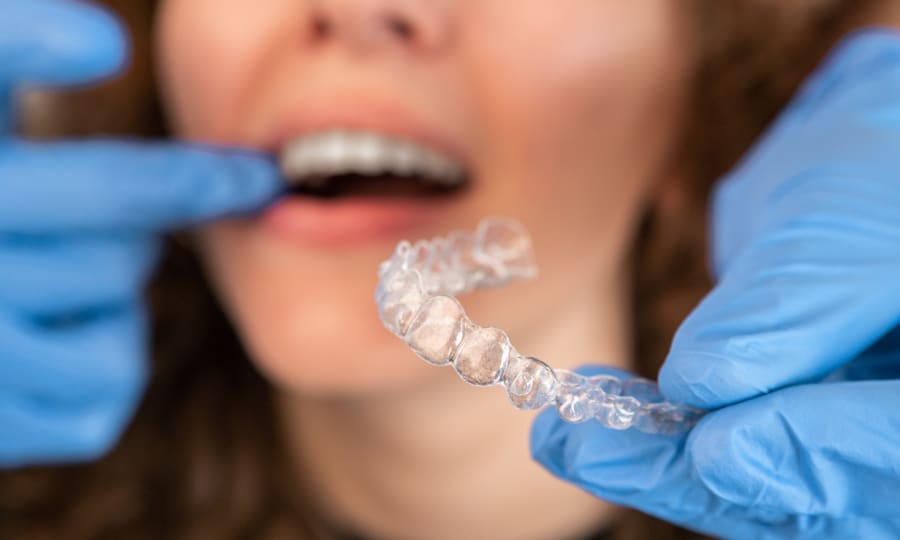 A man holds a pair of Invisalign clear aligners near his mouth.