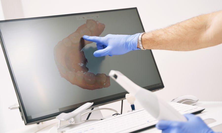 A screen shows a digital rendering of an upper row of teeth.