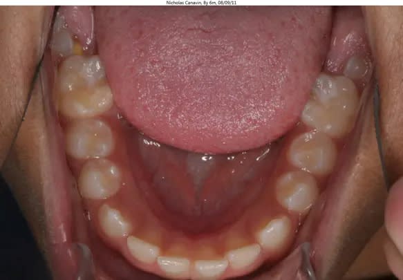 Tip head back, open wide and have a friend take the photo